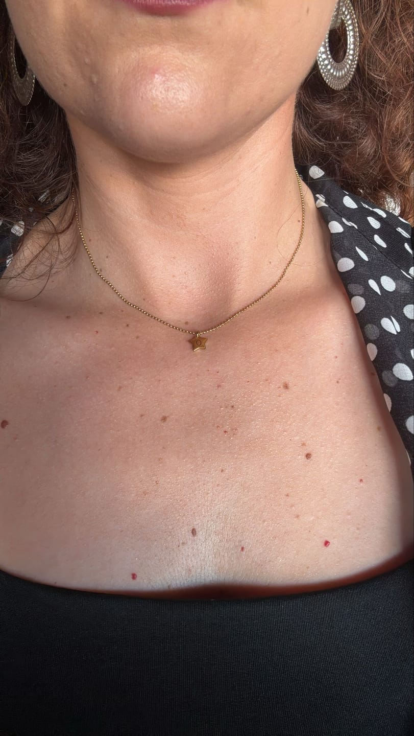 Customer photo review of Collar Five Star - Personalizado