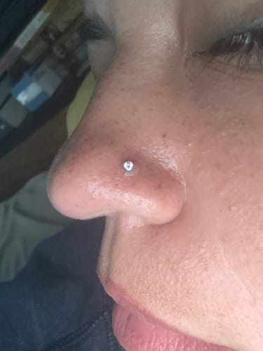 Customer photo review of Keloid Bump & Scar Reducing Gel