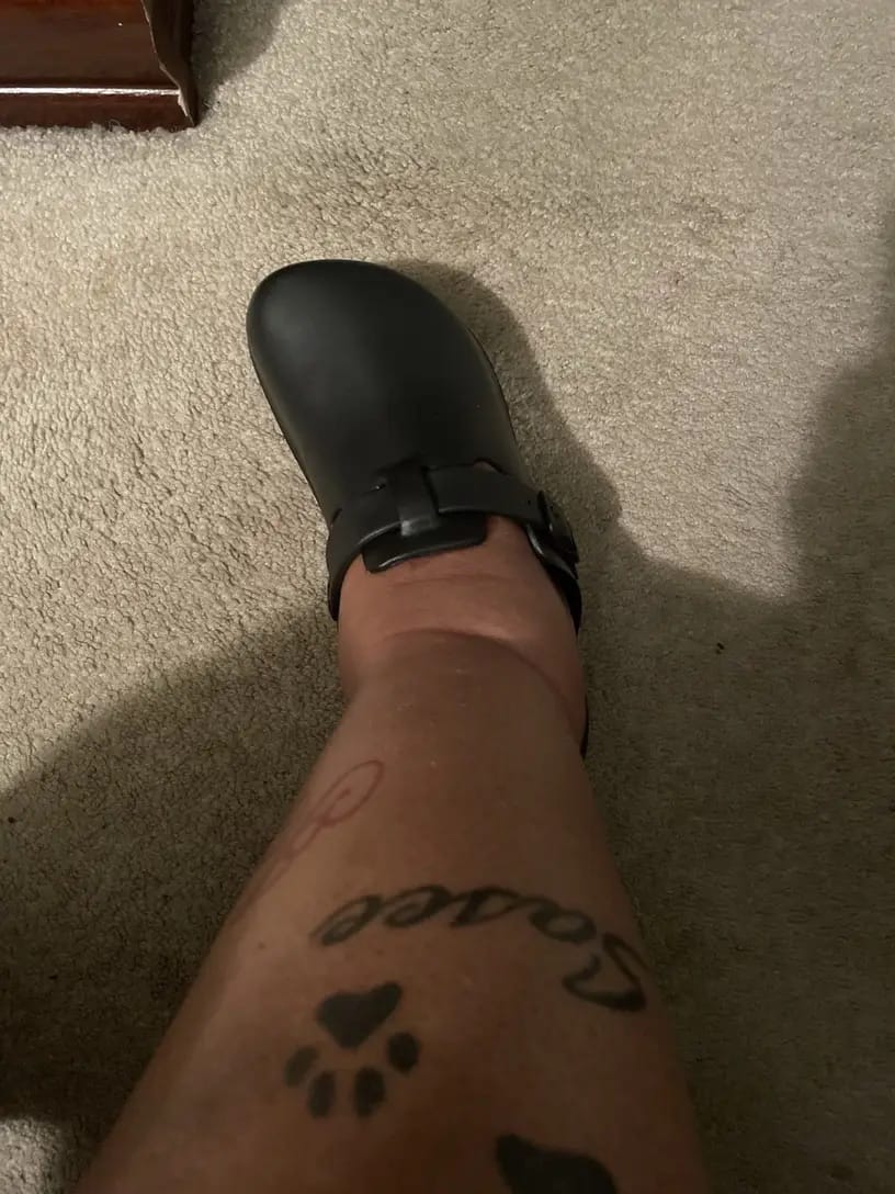 Customer photo review of Vale Classic - Healthy & Non-Slip Comfort Clogs