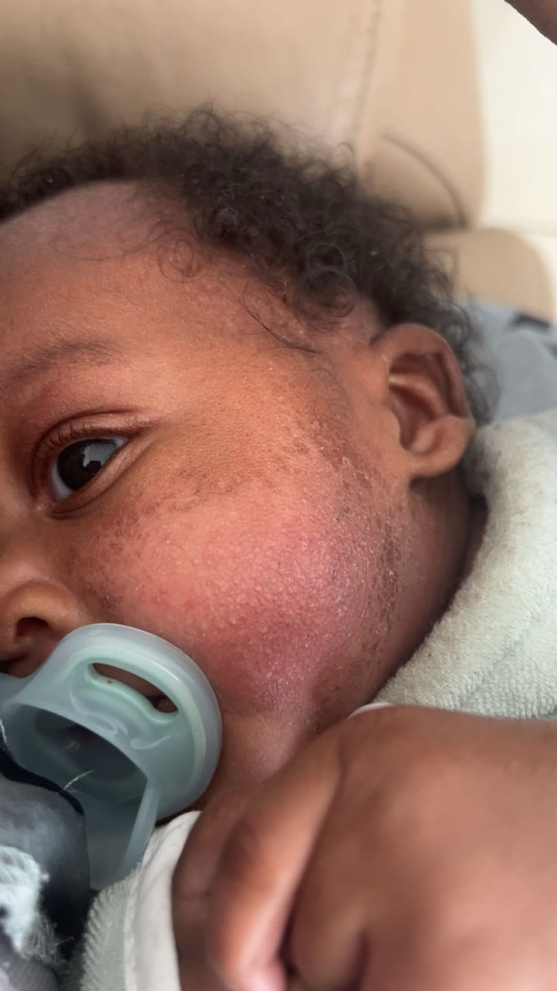 Customer photo review of Bioskin Junior Duo Pack