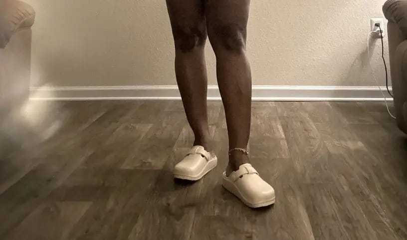 Customer photo review of Vale Classic - Healthy & Non-Slip Comfort Clogs