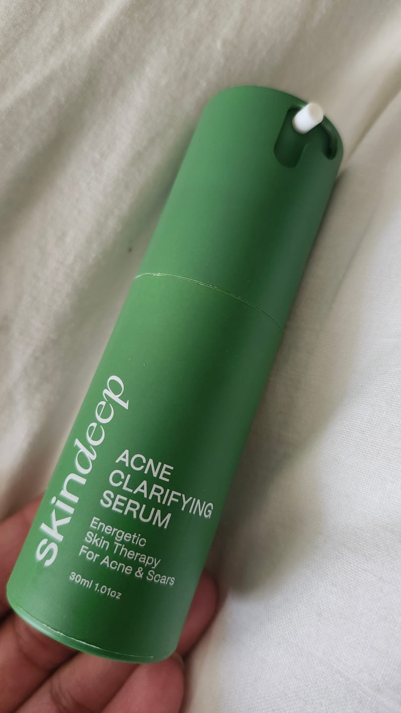 Customer photo review of ACNE CLARIFYING SERUM - Energetic Skin Therapy for Acne & Scars