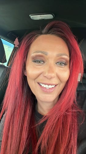 Customer photo review of Click-in Veneers 4.0