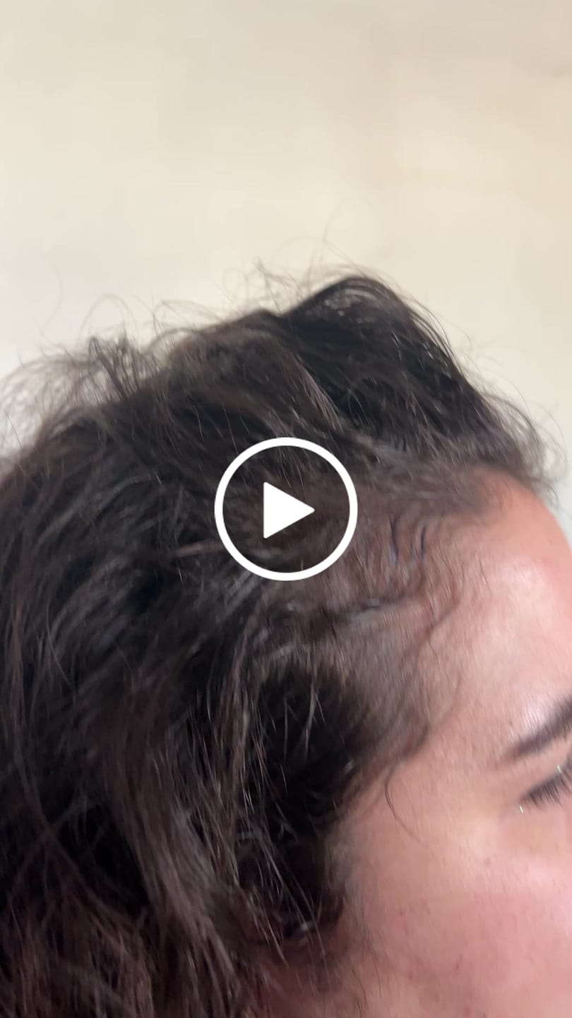 Customer video review of DUO ANTIcaída CRECIMIENTO INTENSIVO Bomba + Tónico
