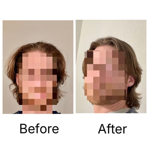 Customer photo review of Shower Water Softener System