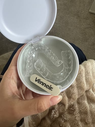 Customer photo review of Essix Retainers