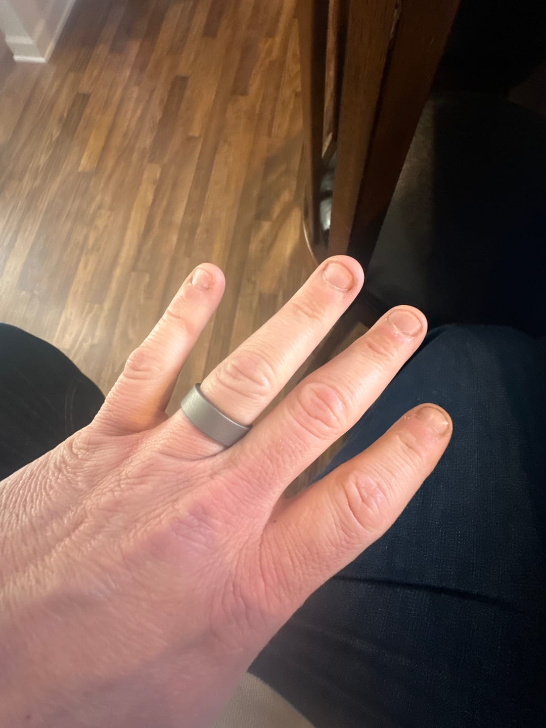 Customer photo review of WW2 Ring