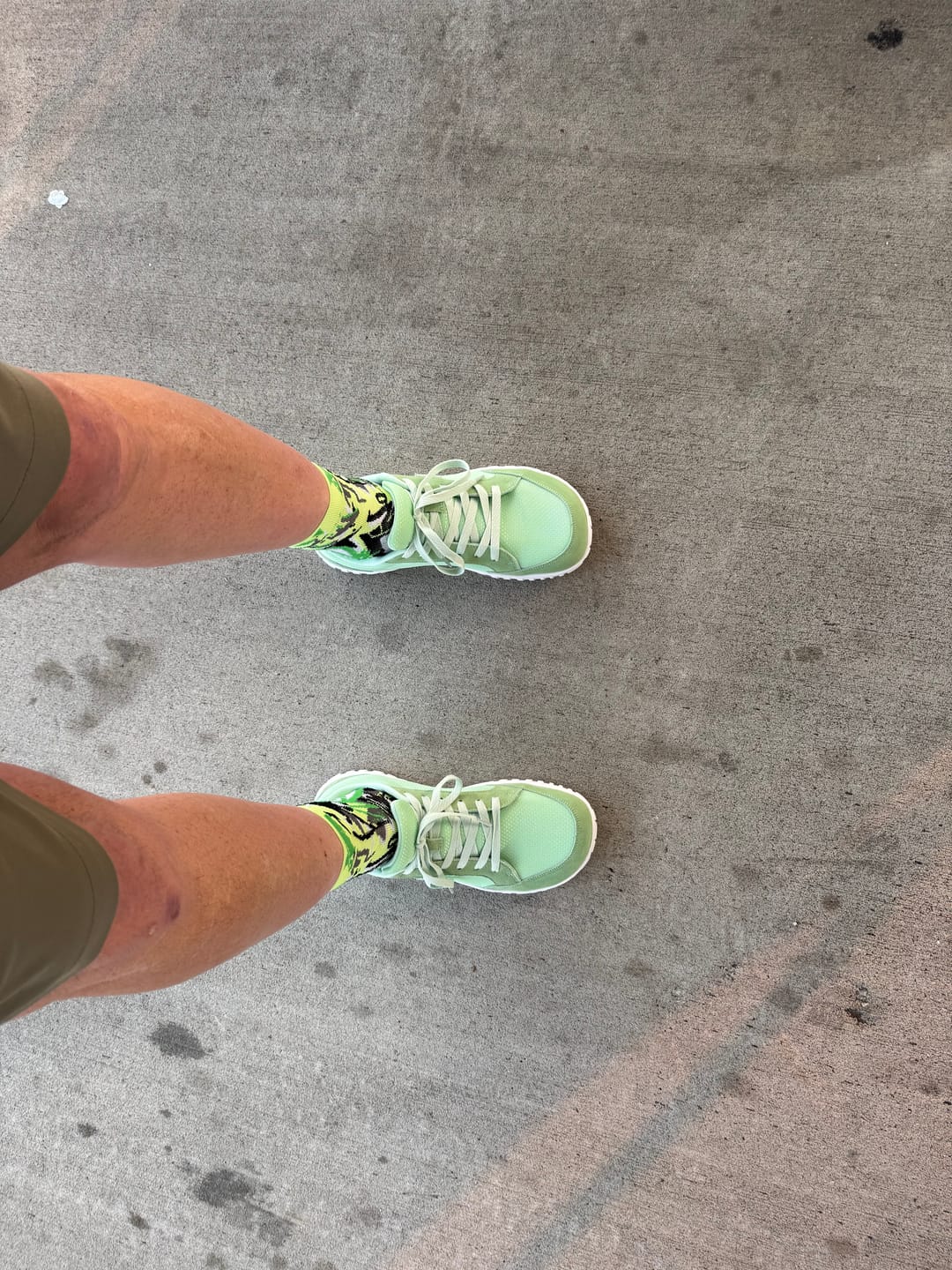 Customer photo review of Dawn - Wide Toe Shoes