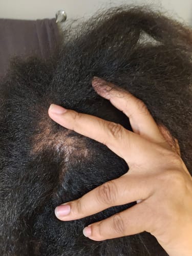 Customer photo review of ‼️35% off TODAY: CODE: BIGOIL35  ‼️ India’s Secret Ancient Ayurvedic Hair Follicle Elixir (5 sizes)