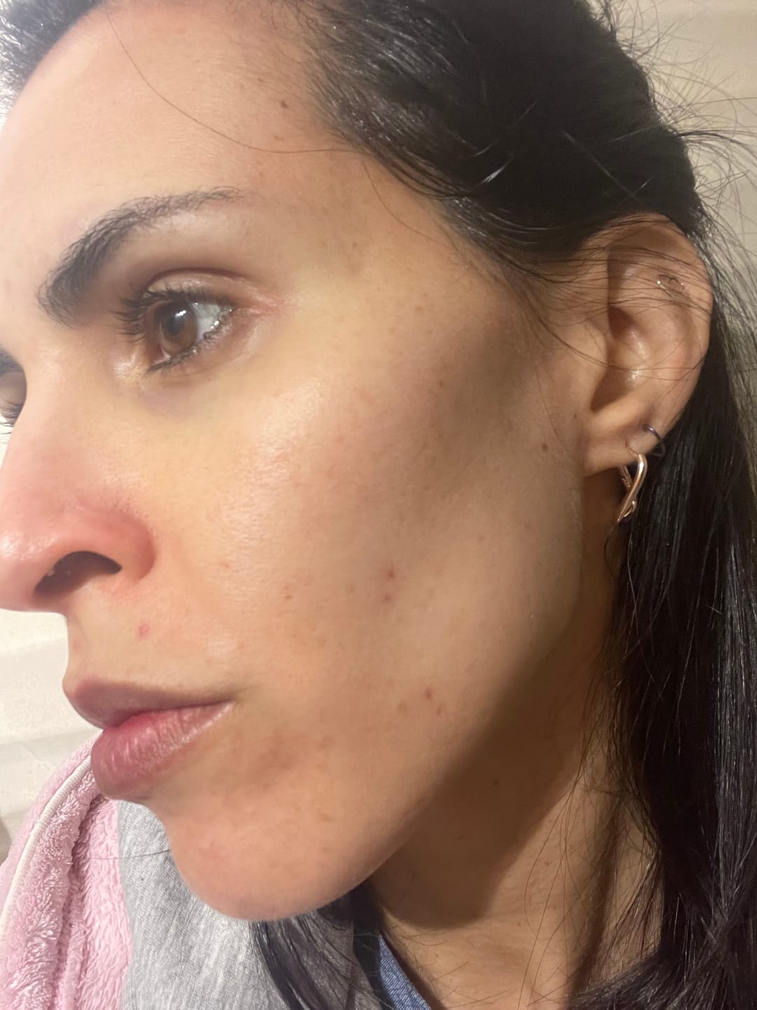 Customer photo review of A.O.X Booster Antioxidante con vitamina C