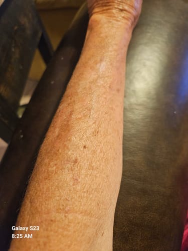 Customer photo review of Besque™ Magic Body Oil - 100ml