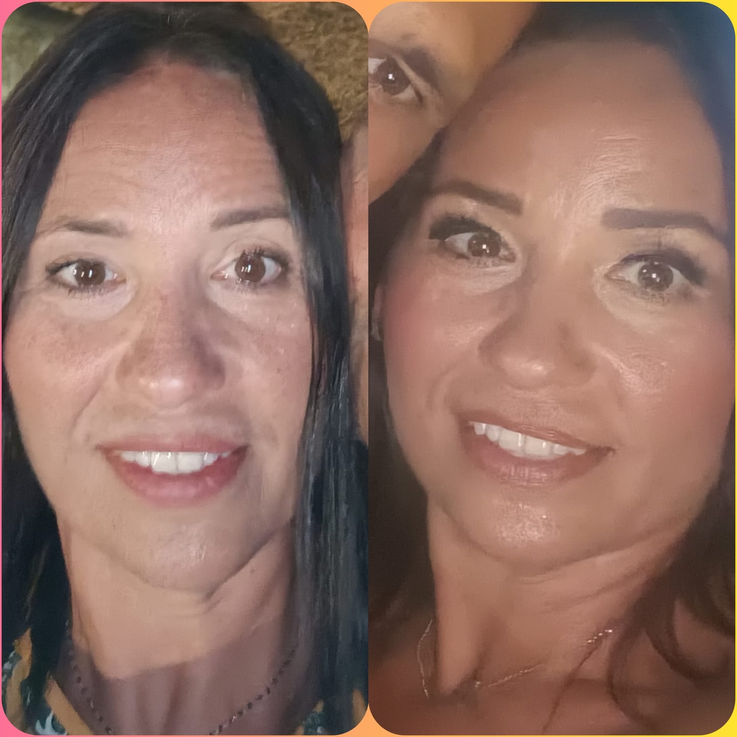 Customer photo review of COLLAGENE LIQUIDO™️ Trattamento d'urto