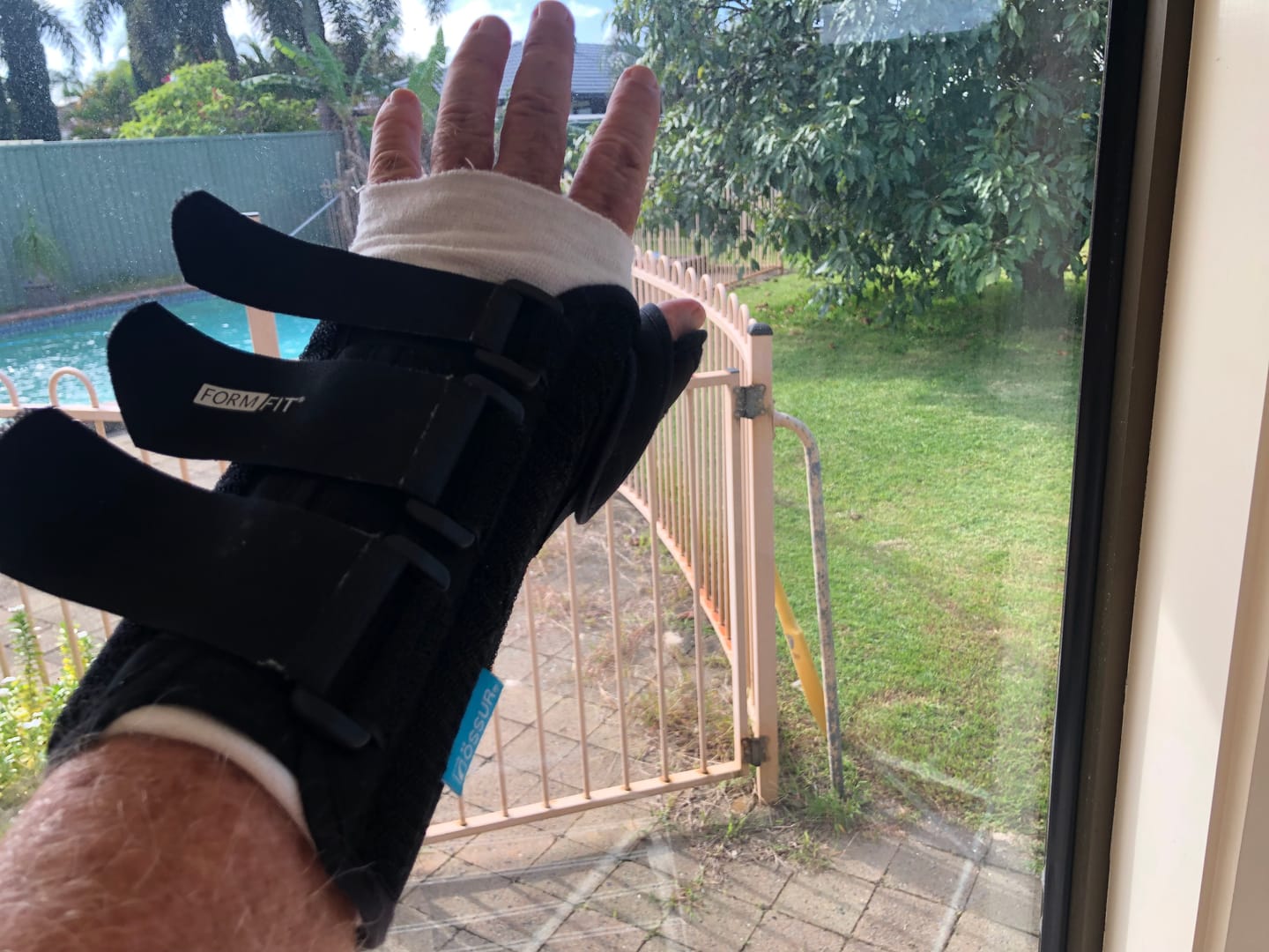 Customer photo review of Motorcycle Wrist Support - Ride Without Wrist Pain