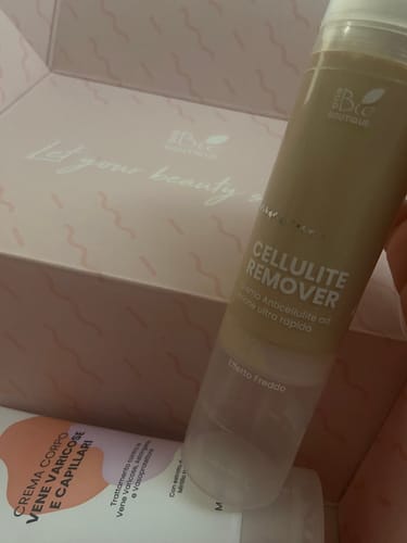 Customer photo review of Cellulite Remover