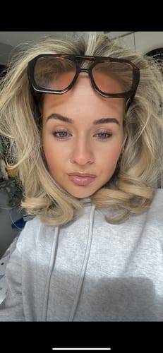 Customer photo review of RADIANT SKIN TINT