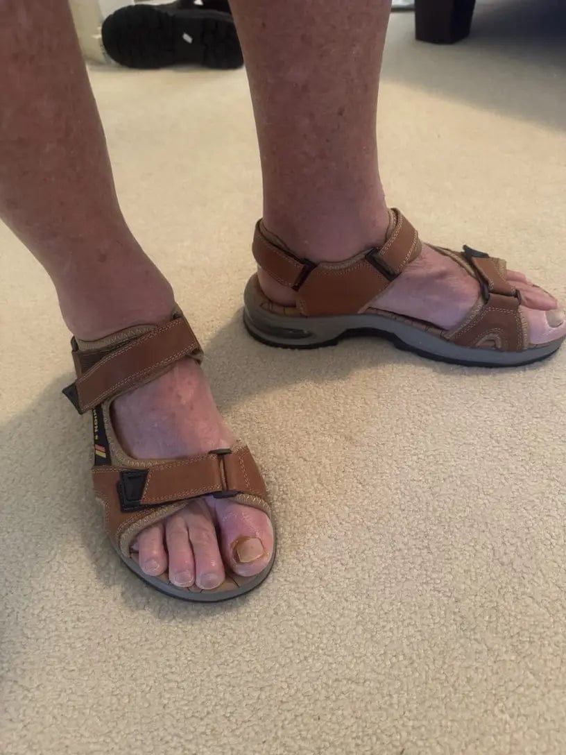 Customer photo review of 💯Summer Collection 💯Men's Orthopedic Leather Sandals – Breathable, Adjustable, Air Cushion