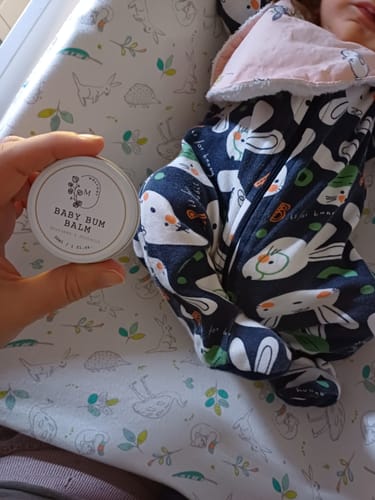 Customer photo review of Baby Bum Balm