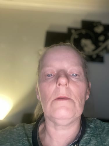 Customer photo review of Youth Boost