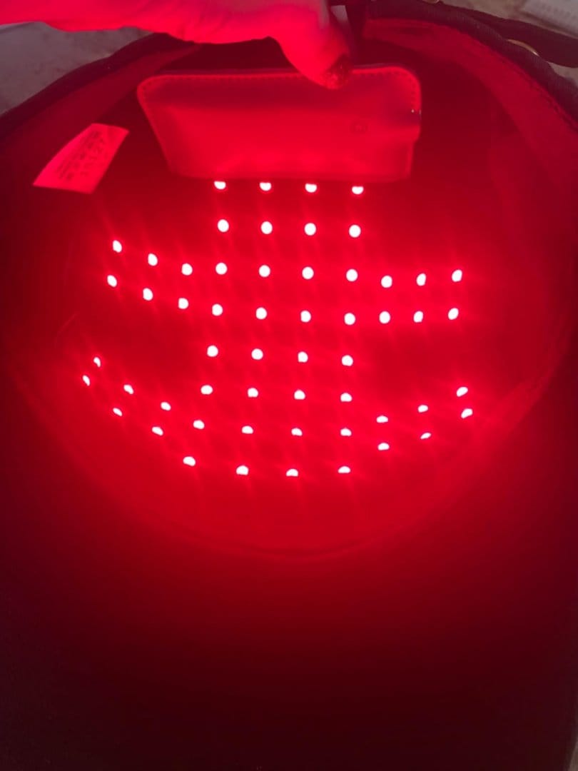 Customer photo review of LED Therapy Cap