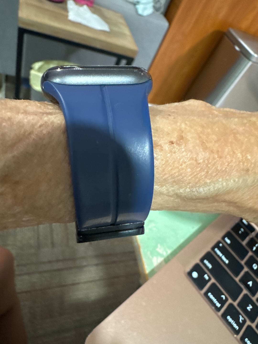 Customer photo review of FlexiFit™ Magnetic Band for Apple Watch - BUY 1 GET 1 FREE!