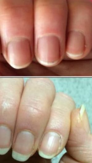 Customer photo review of Coffret Boosters Masila – Cils & Sourcils + Ongles & Cuticules