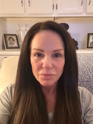 Customer photo review of Neptune Grass Fed Tallow & Honey Balm