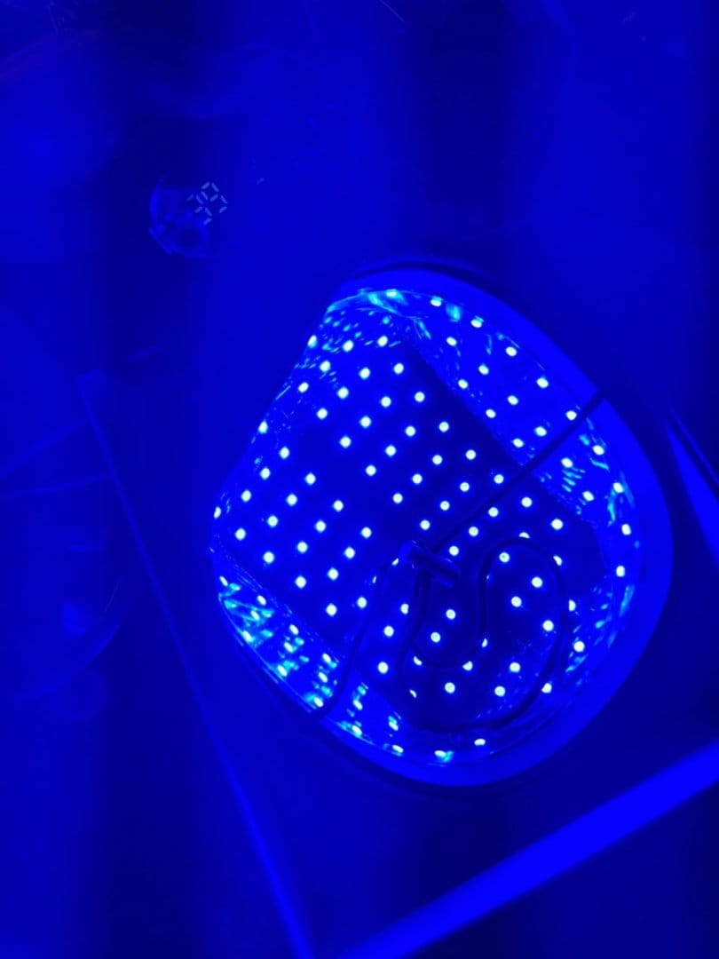 Customer photo review of LED Therapy Cap