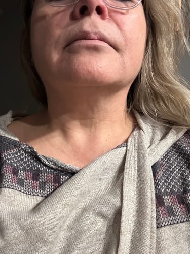 Customer photo review of Glov Micro Infusion System