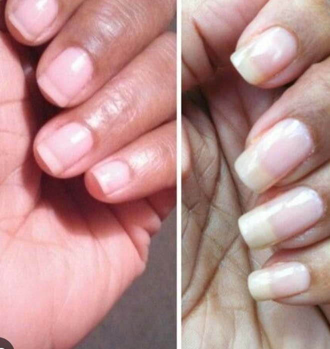 Customer photo review of Coffret Boosters Masila – Cils & Sourcils + Ongles & Cuticules