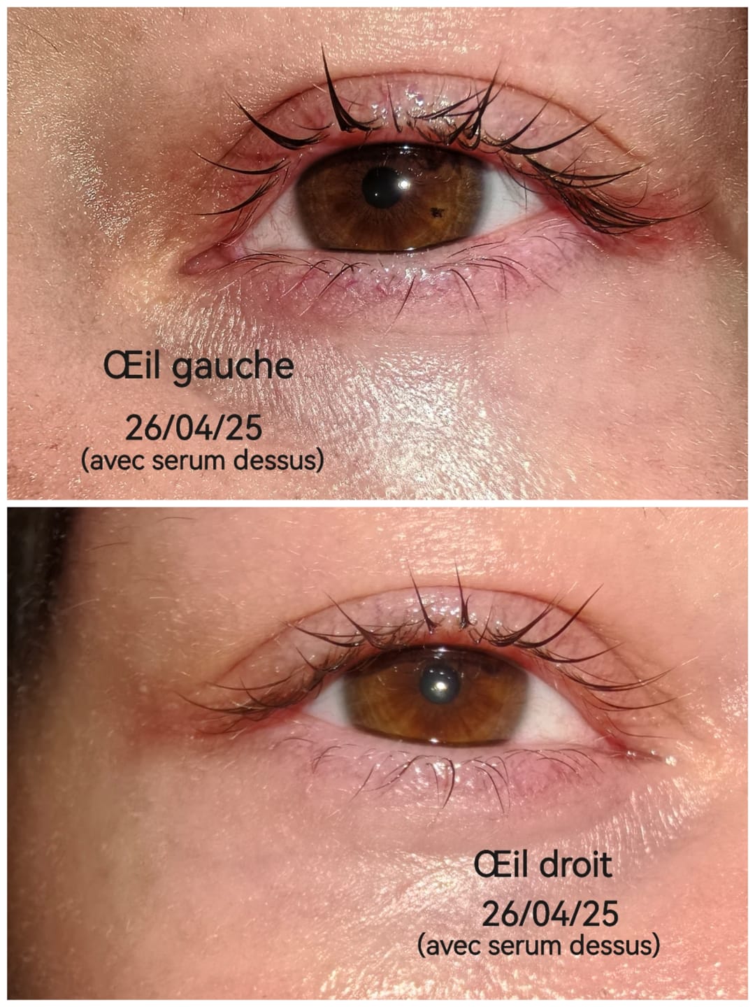 Customer photo review of SÉRUM AURA LASH