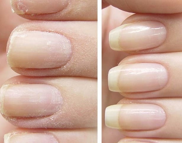 Customer photo review of Coffret Boosters Masila – Cils & Sourcils + Ongles & Cuticules