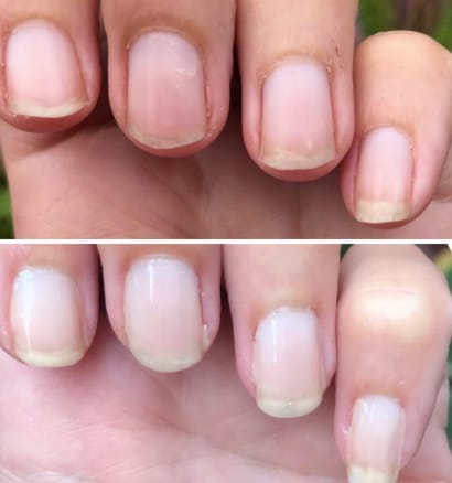 Customer photo review of Coffret Boosters Masila – Cils & Sourcils + Ongles & Cuticules