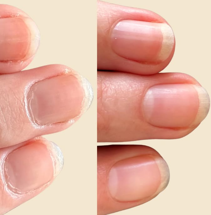 Customer photo review of Coffret Boosters Masila – Cils & Sourcils + Ongles & Cuticules