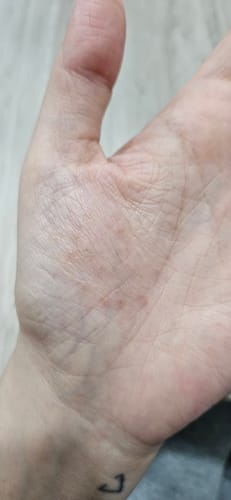 Customer photo review of Jolicare Cream