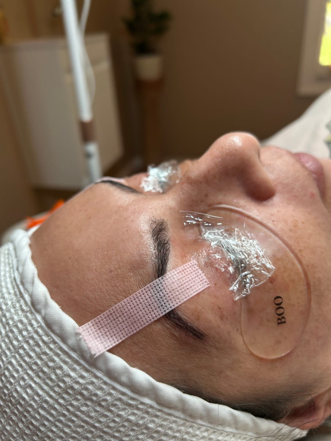 Customer photo review of Hypoallergenic Reusable Eye Pads