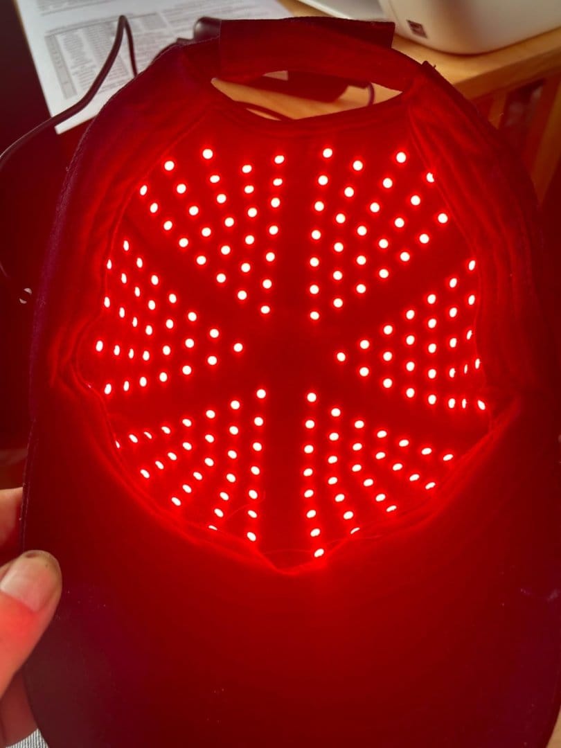 Customer photo review of LED Therapy Cap