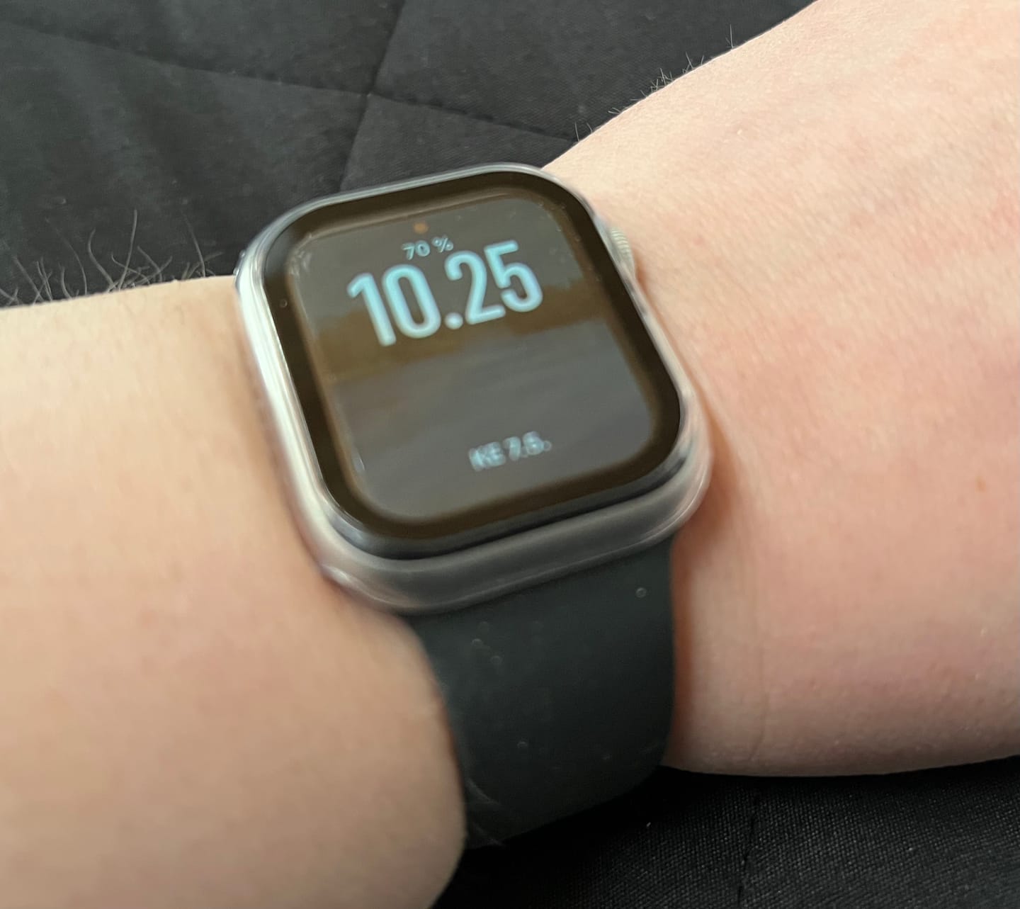 Customer photo review of Apple Watch suojakotelo - Läpinäkyvä