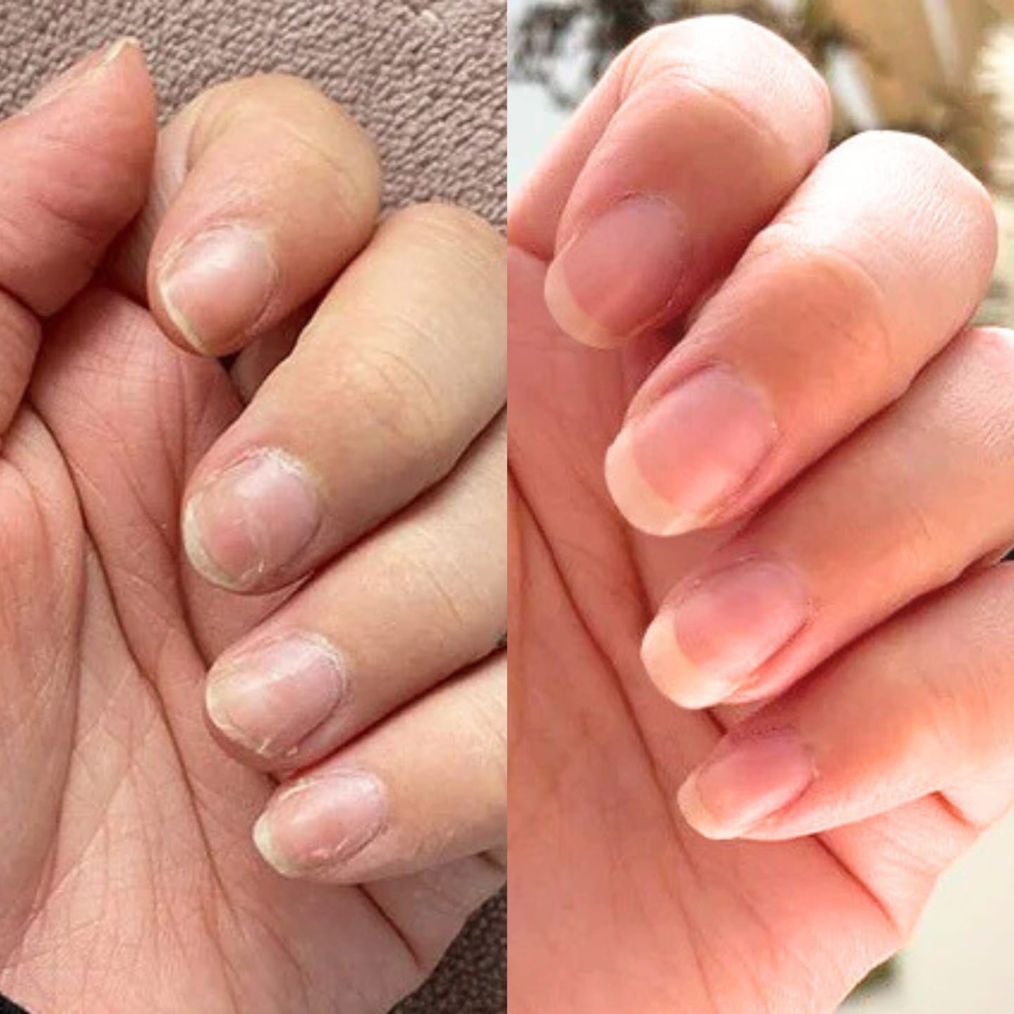 Customer photo review of Collagen Shot