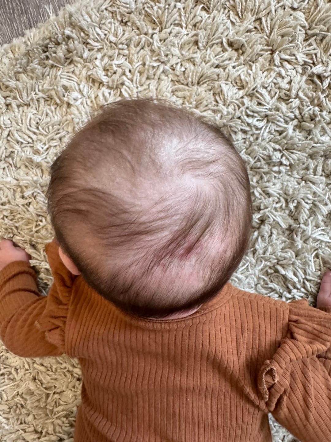 Customer photo review of Baby Scalp Oil