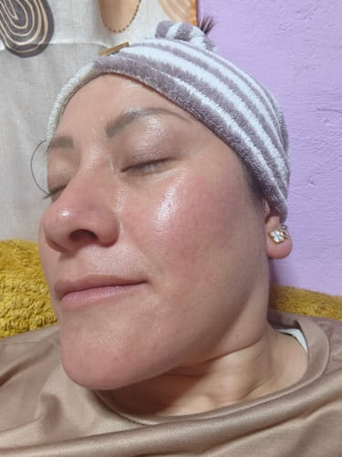 Customer photo review of Seyoul™ Células madre Mesowhite - H01