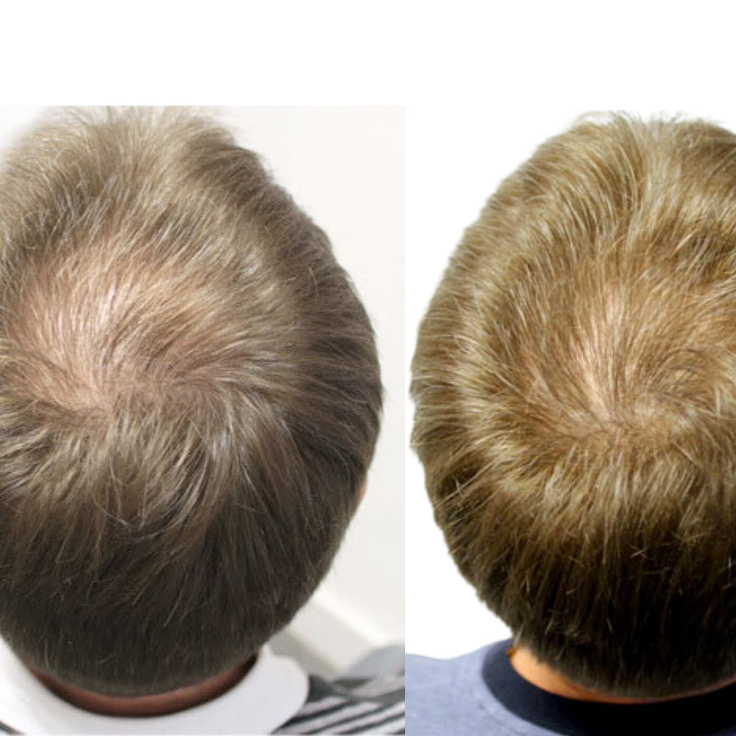 Customer photo review of Collagen Shot
