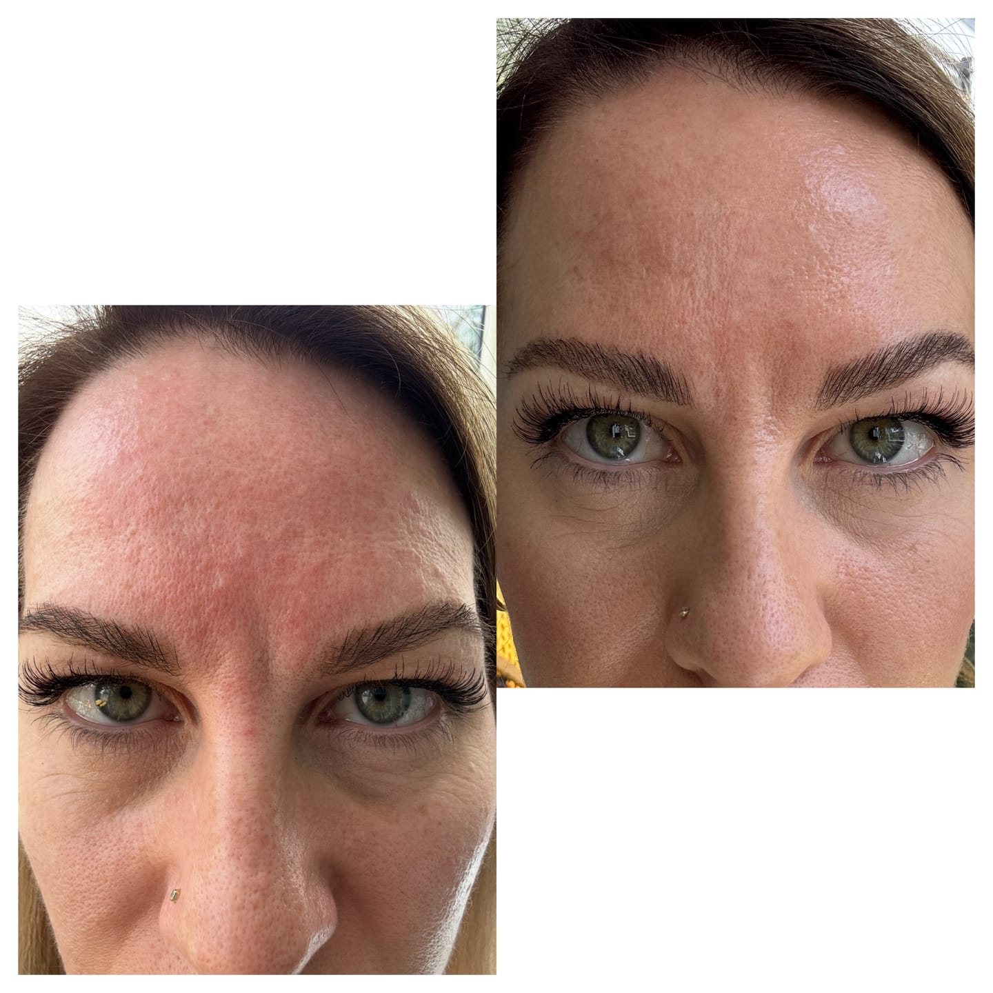Customer photo review of The Miracle Collection