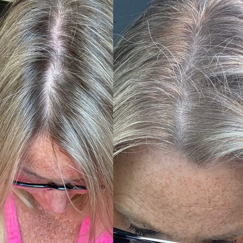 Customer photo review of Sunkissed Refill 1-pack