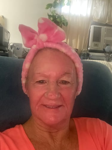 Customer photo review of 16 Pin Replacement Cartridges for M8 PowerDerm (10 pack)