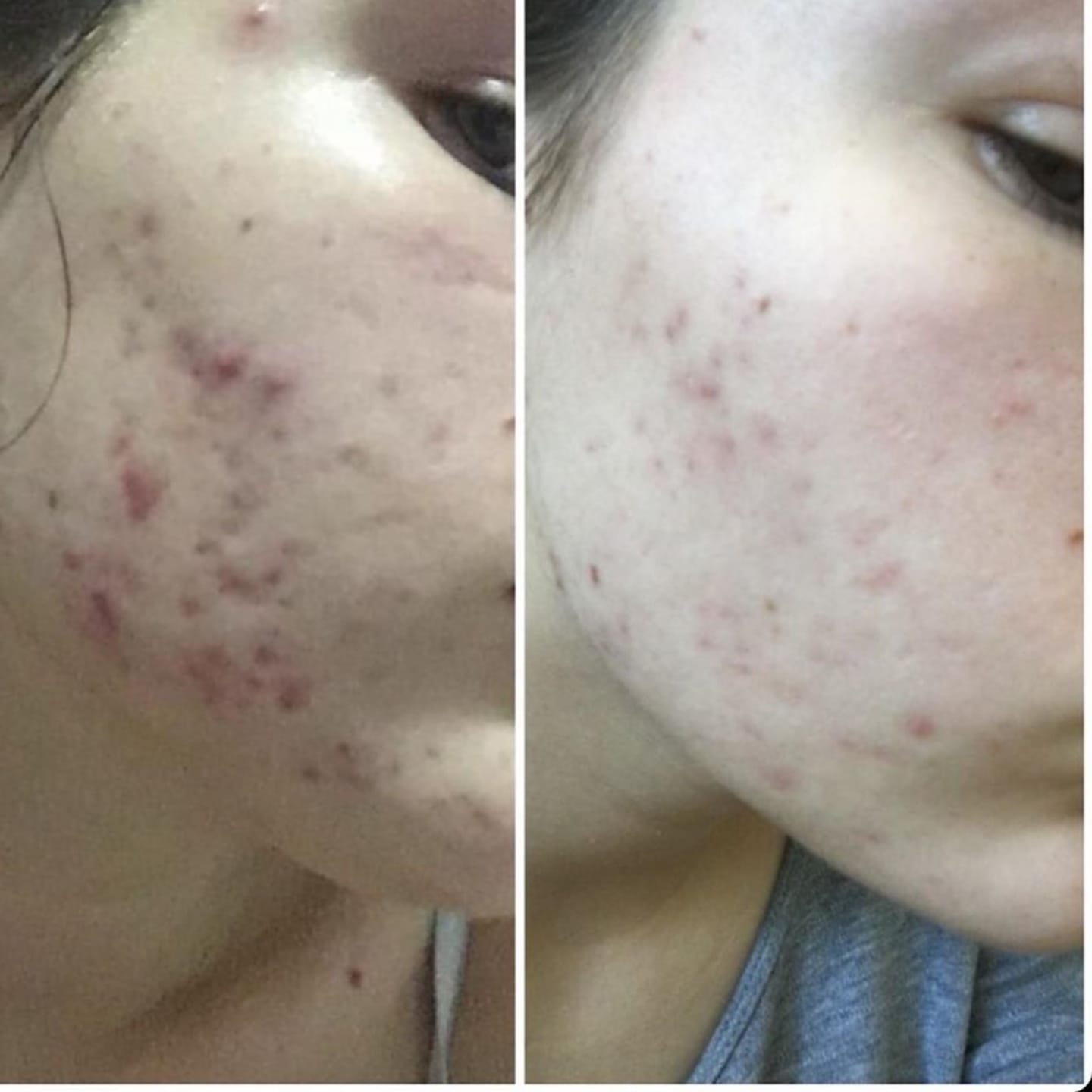 Customer photo review of Collagen Shot