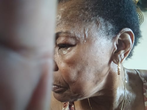 Customer photo review of Rennora Hair Growth Serum