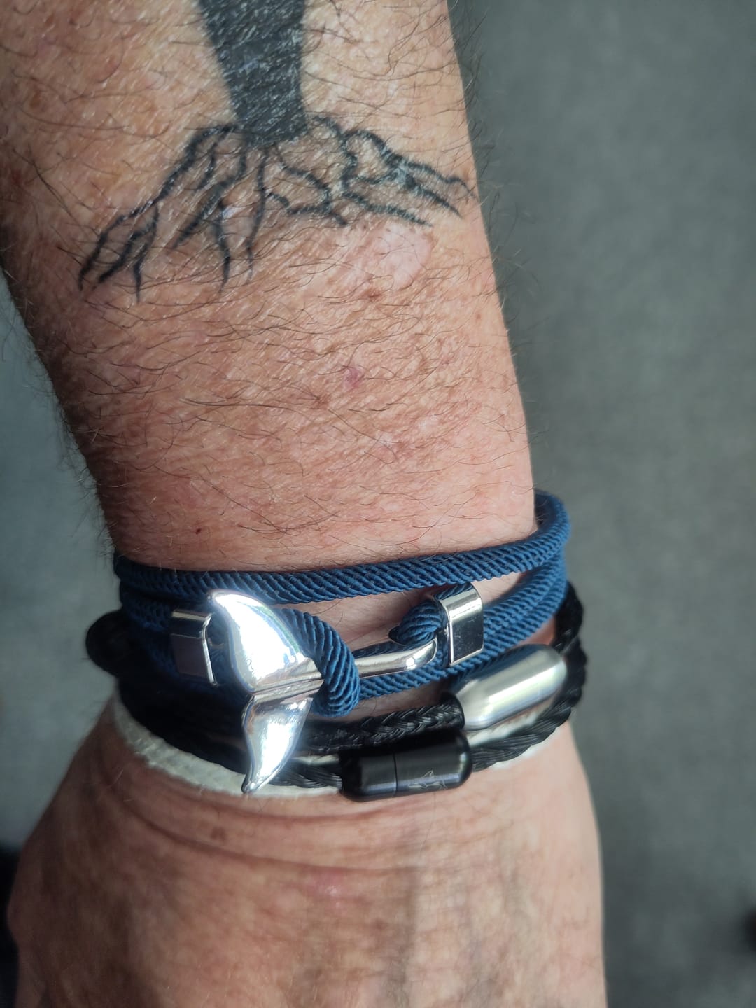 Customer photo review of Whale Tracking Bracelet