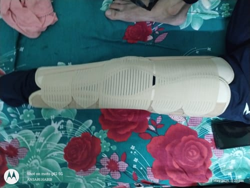 Customer photo review of Knee Brace - Long (19" Brace) | Ideal firm Knee support that limits knee motion & stabilizes the knee with mediolateral metal supports | Color - Beige