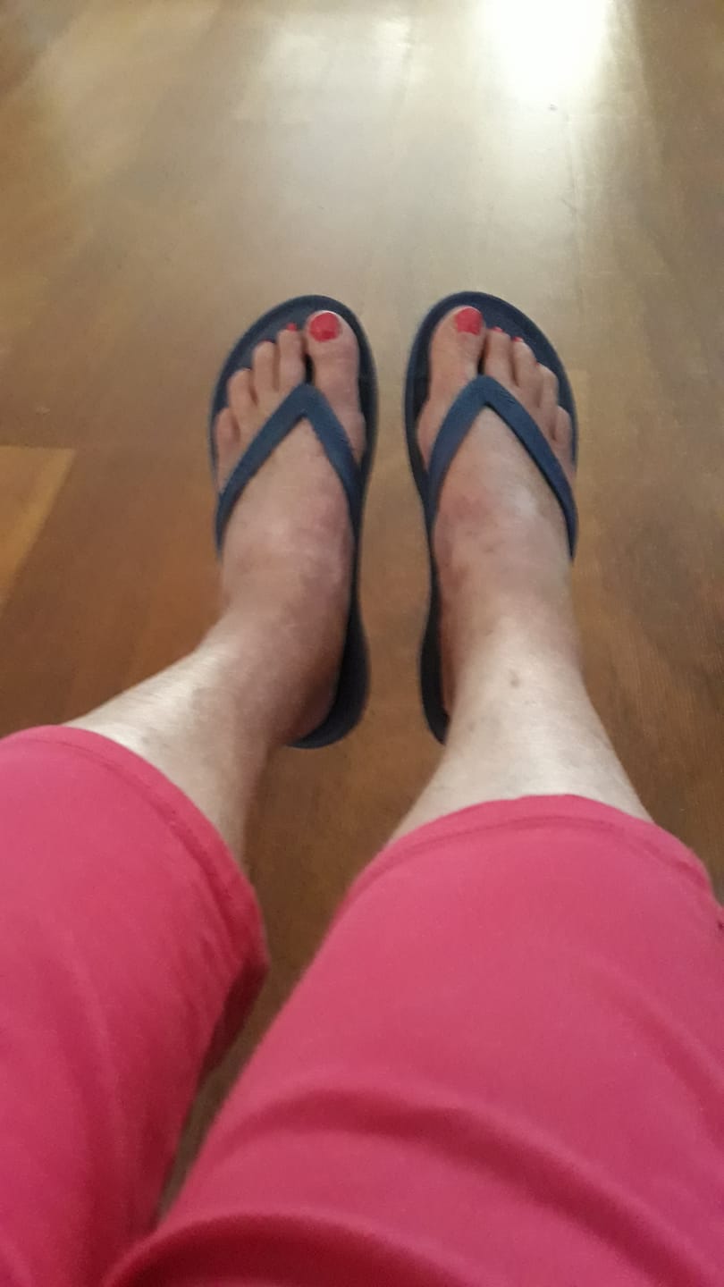Customer photo review of Black - Arch Support Thongs