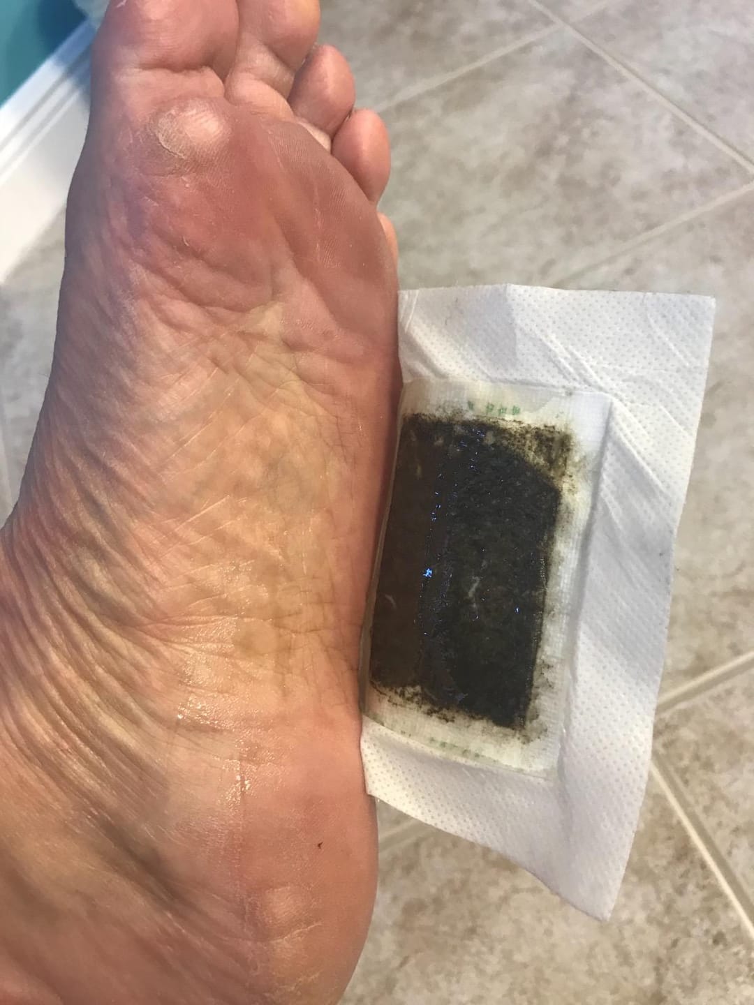 Customer photo review of DetoxiPad Éjszakai Méregtelenítő Tapasz